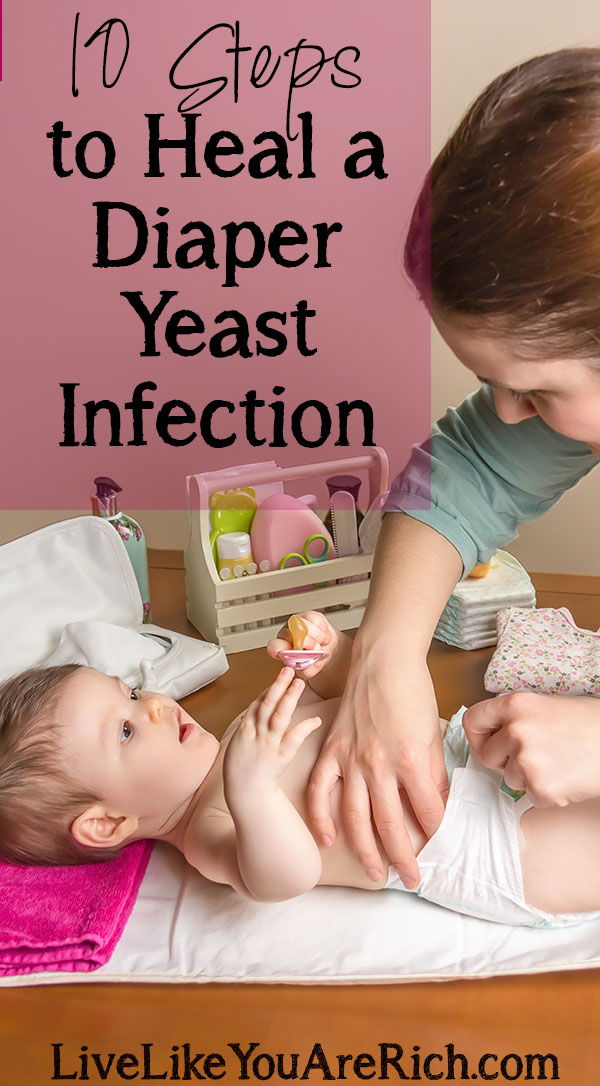 How to Cure Diaper Yeast Infections