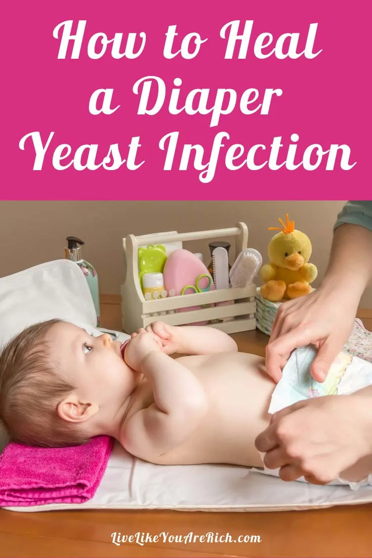 A yeast rash tends to hang around for longer than two days and doesn't respond to traditional diaper rash treatments. Here are 10 steps to take when your child gets a diaper yeast infection. #diaperrash #yeastinfection #naturalremedies